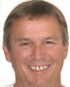 advanced gum disease prosthodontics ff1 1