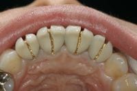 captek5