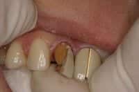 captek6