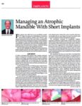 managing an atrophic mandible
