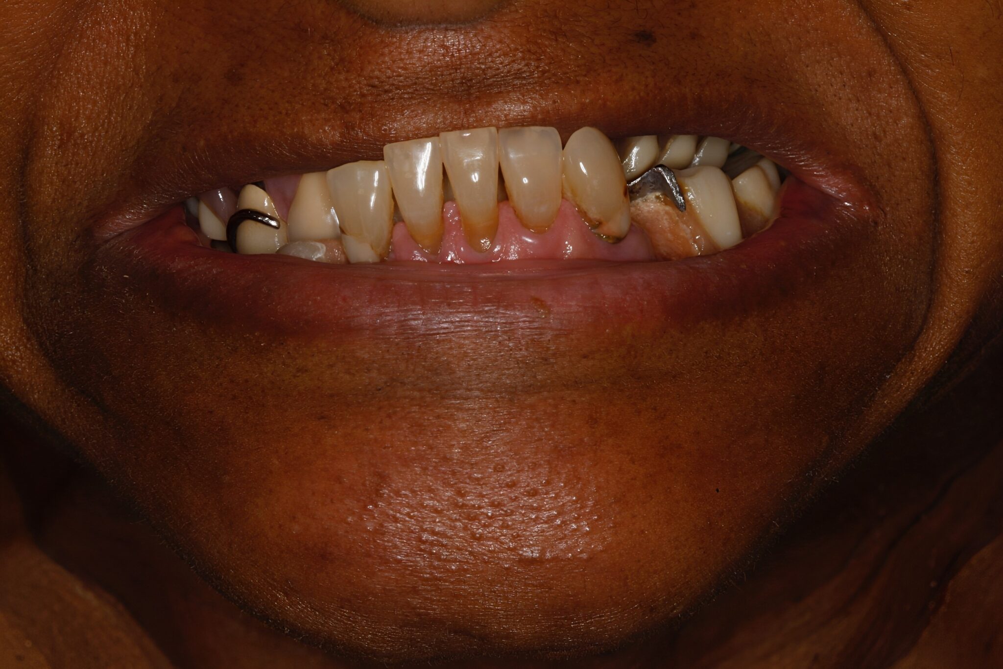 Dental Specialist Milwaukee Cosmetic & Reconstructive Dentistry Services