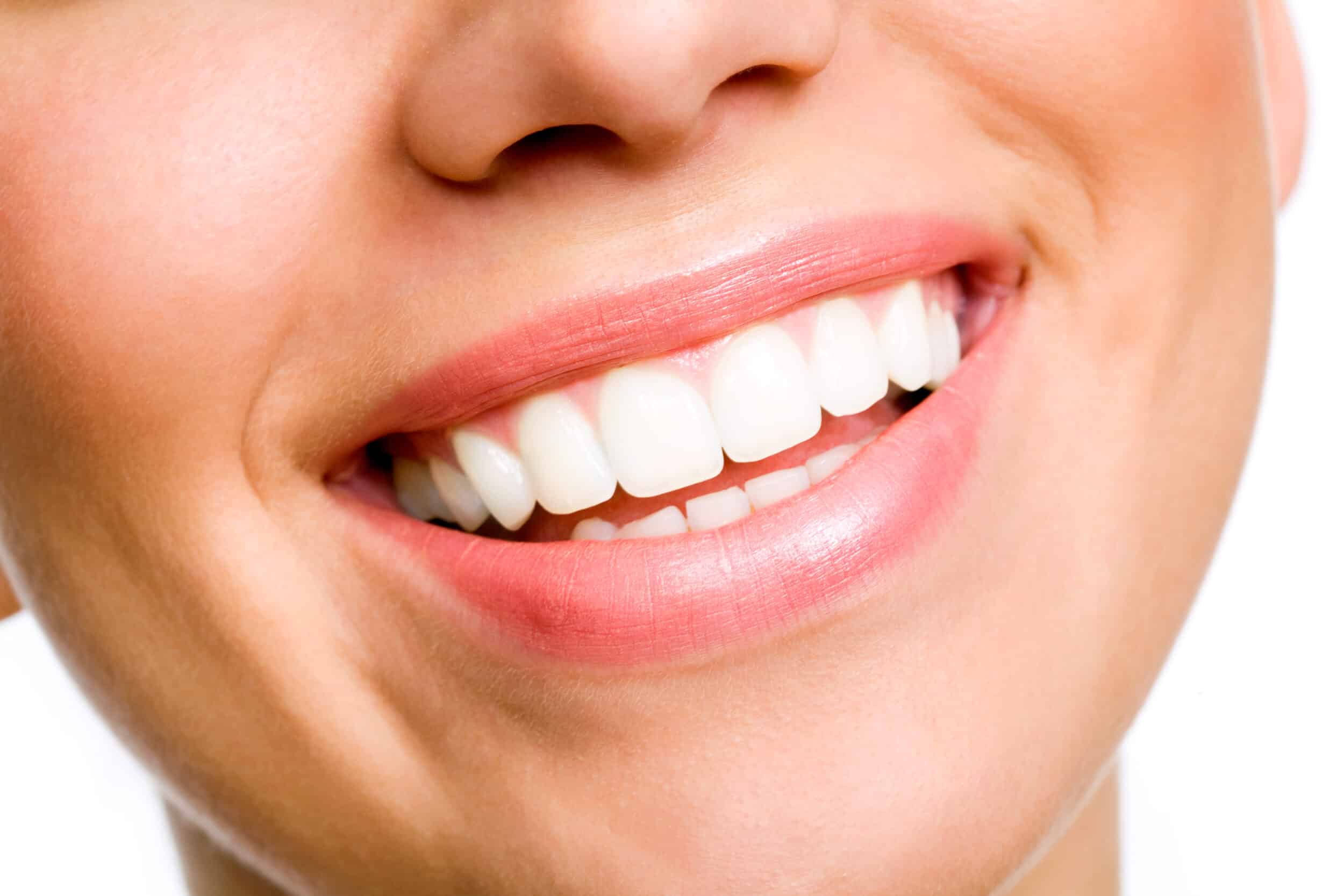 Close up of woman's bright, white smile after KöR Teeth Whitening