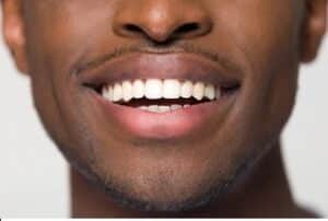 Close up of man's smile with implant-retained dentures in Milwaukee, WI