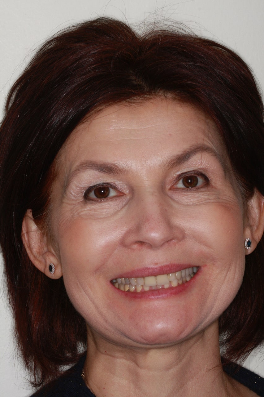 General Dentistry Before