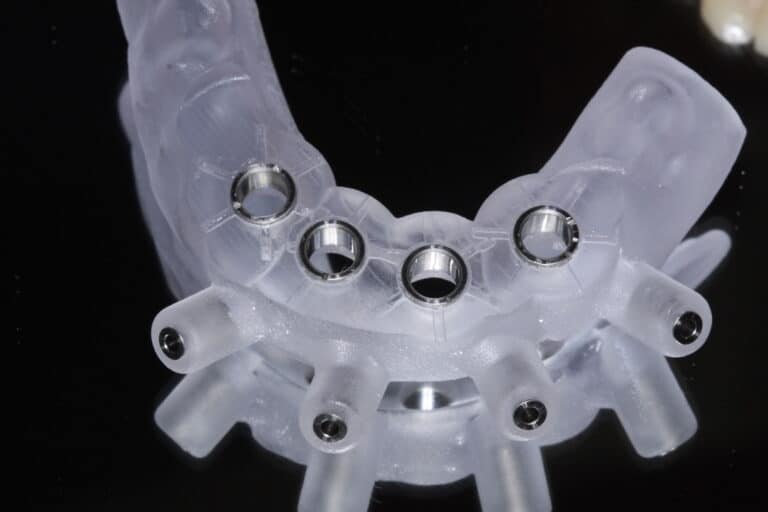 After Image: Overdenture - front
