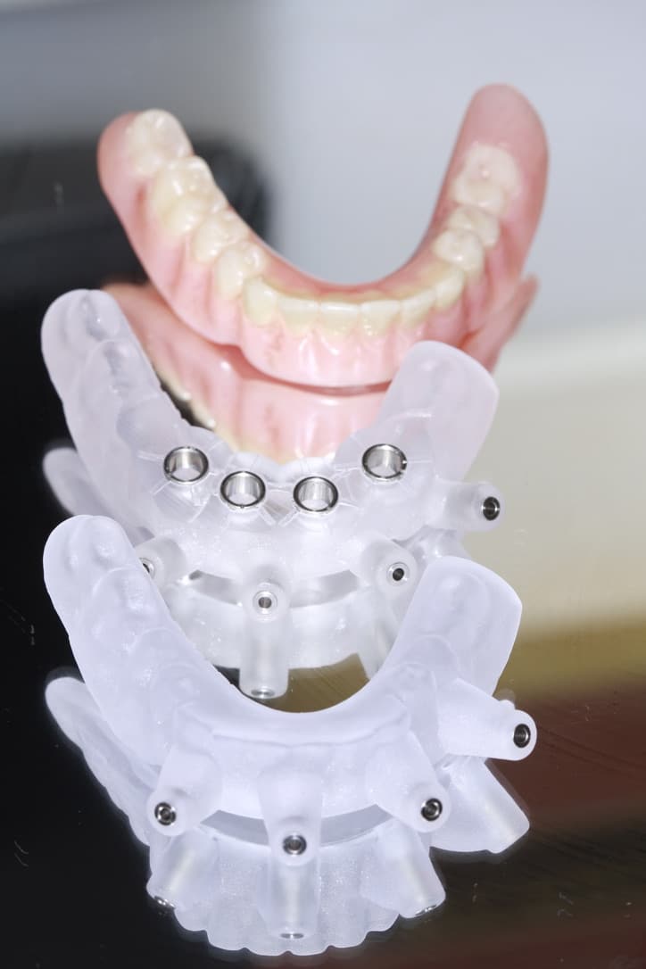Before Image: Overdenture - front