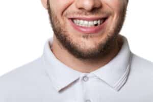 Close up of a man's smile with a missing tooth in Milwaukee, WI