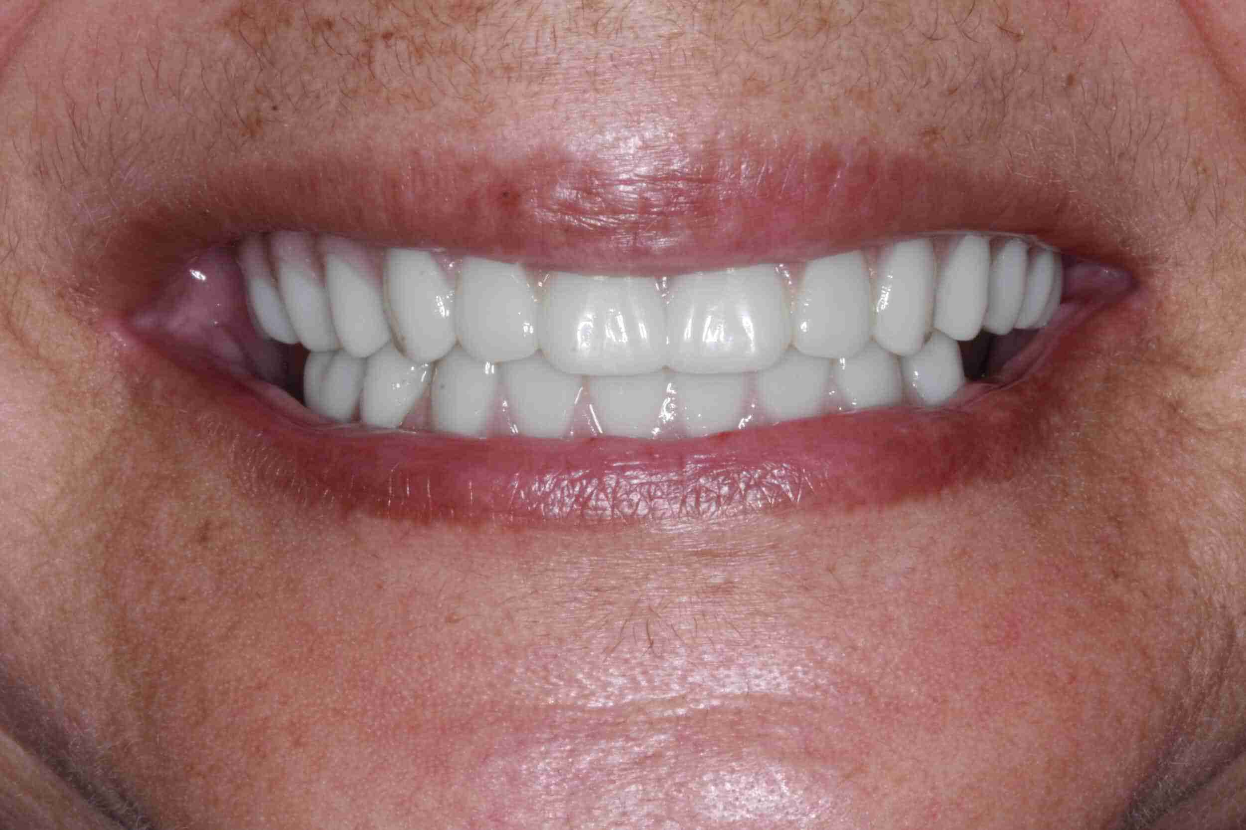 Cosmetic Dentistry in Milwaukee