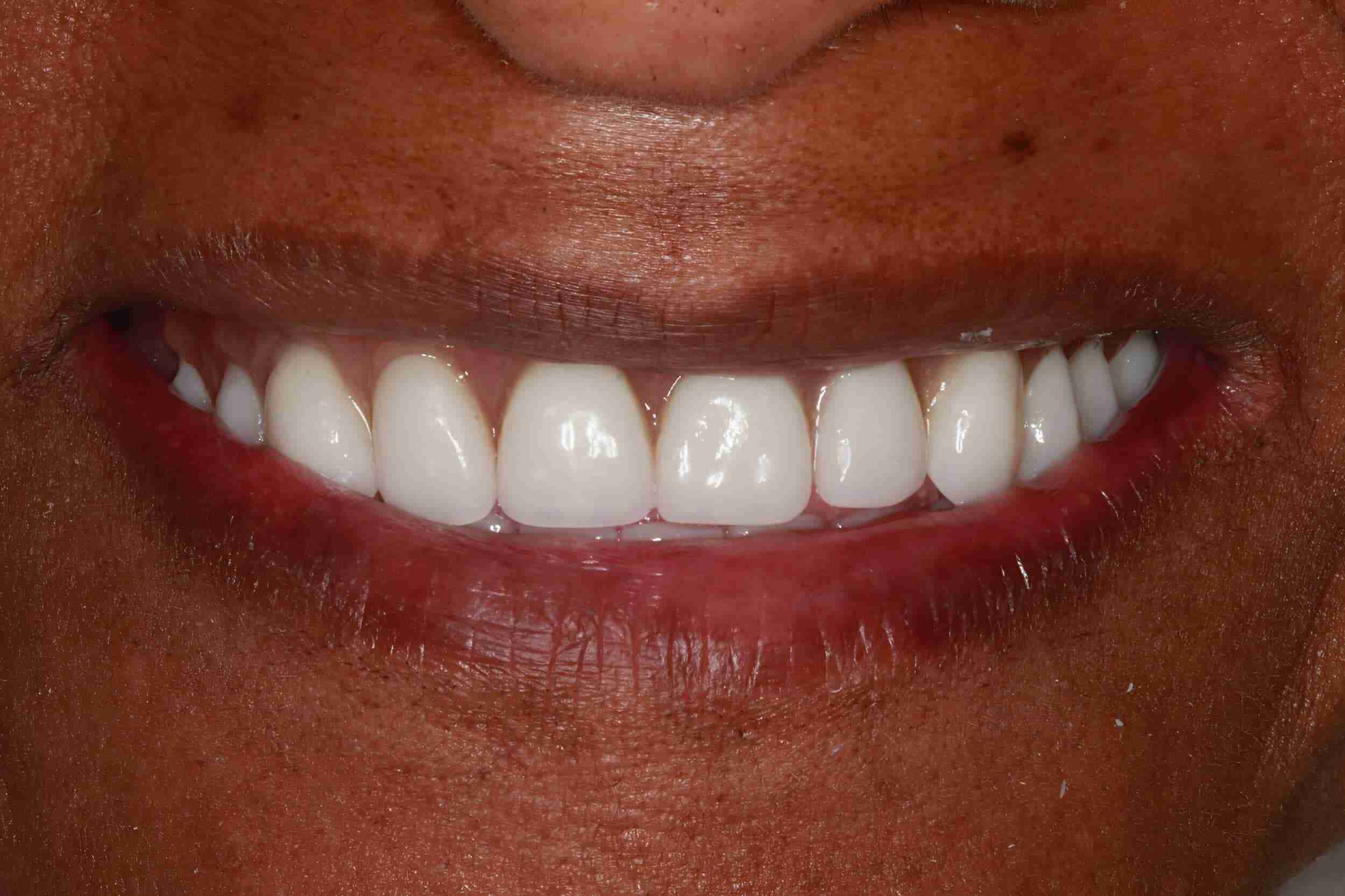 After-scaled-1
