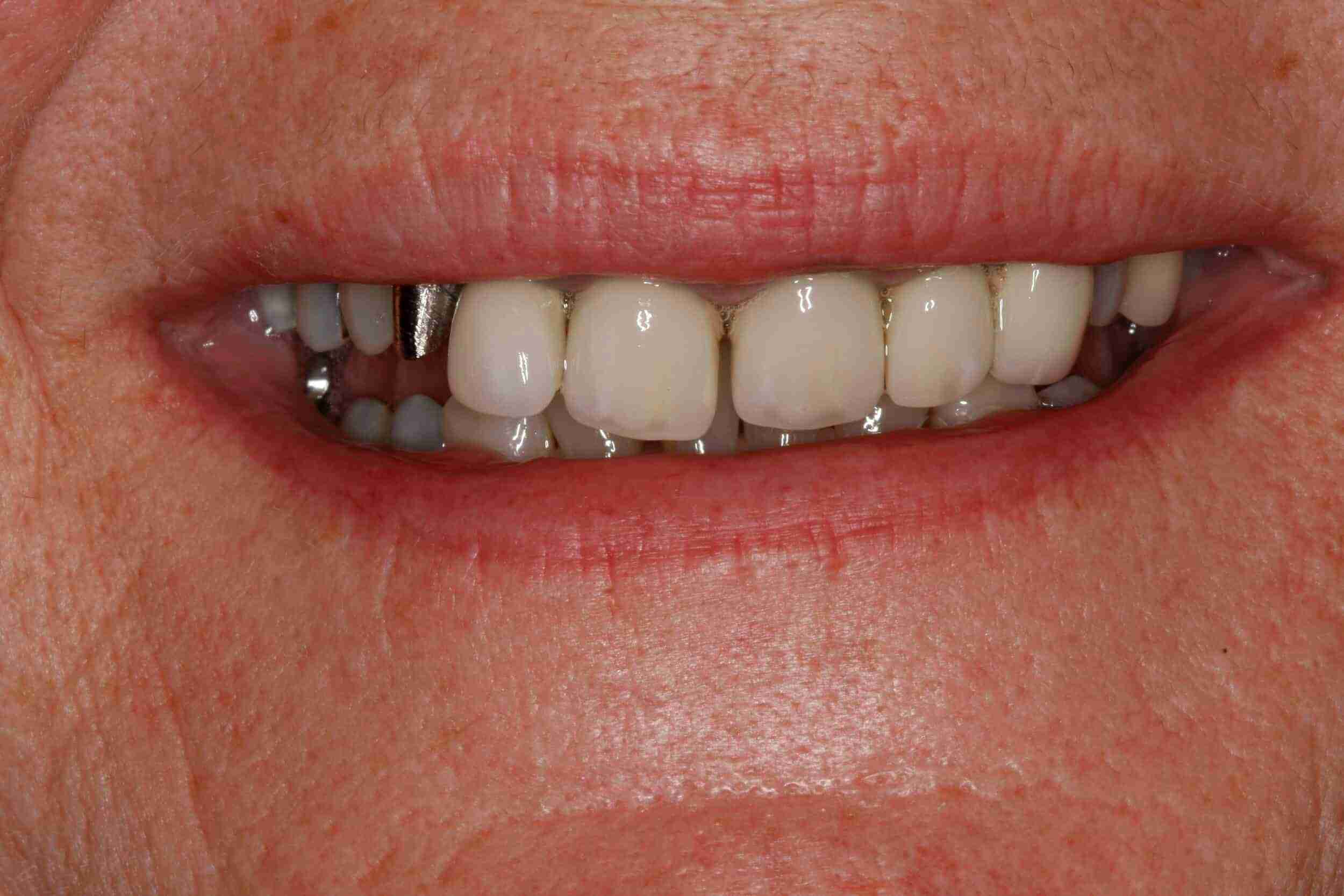 Dental Patient Photos in Milwaukee