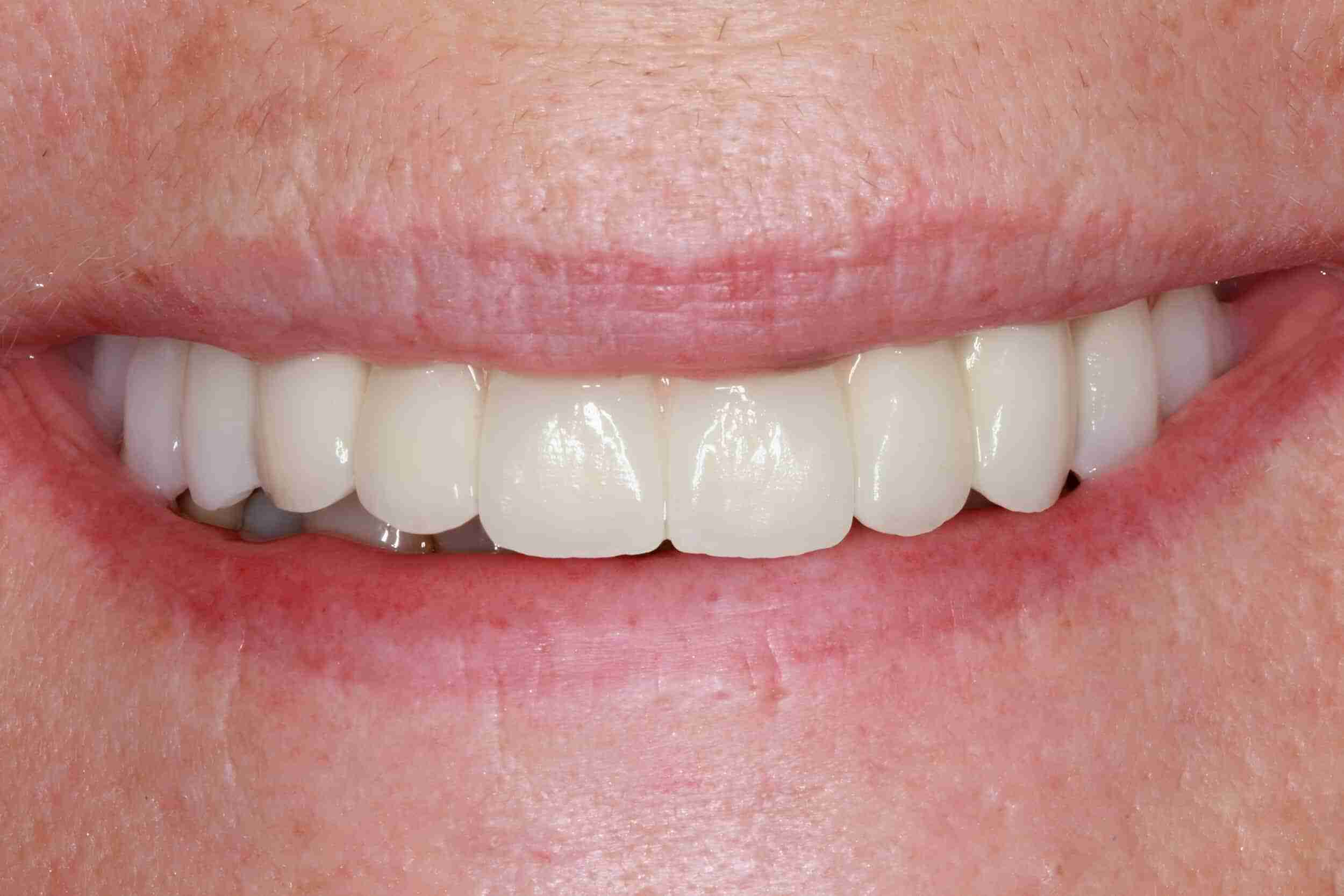 Dental Photos in Milwaukee