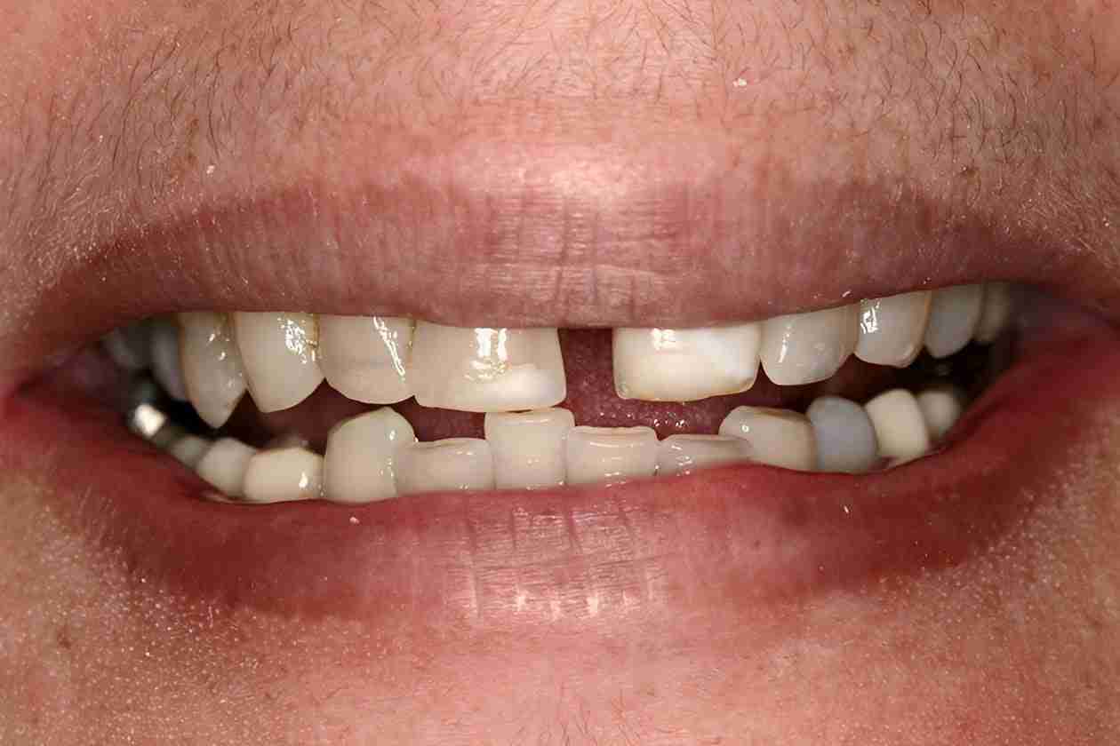 Dental Gallery