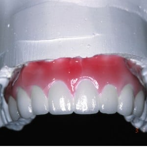 After Image