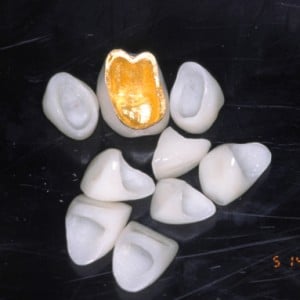 Before Image