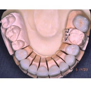 After Image