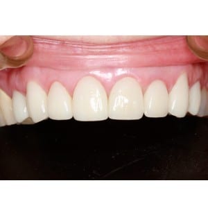 Before Image